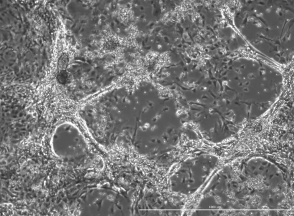 Beating clusters of cardiomyocytes differentiated from human induced pluripotent stem cells (iPSCs). Viswanathan Rajagopalan Lab. ©2024.